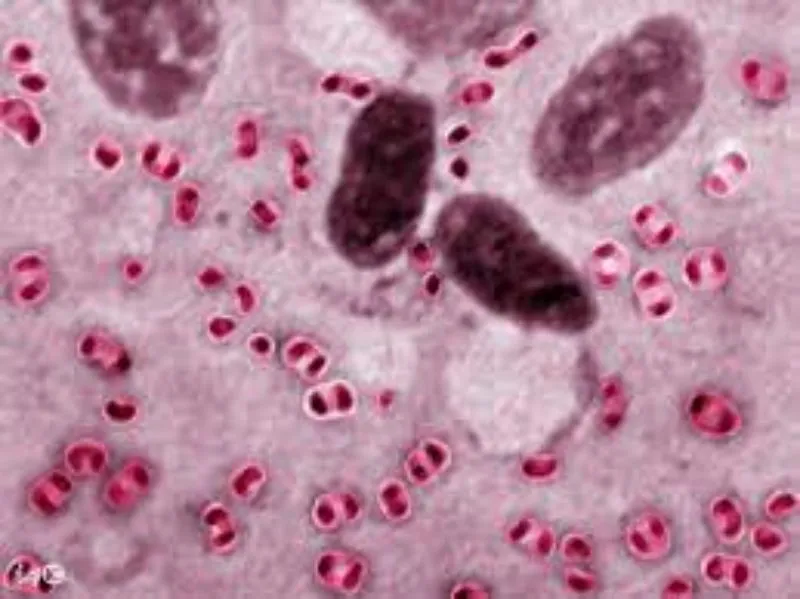 Pasteurella multocida là virus gây ra bệnh tụ huyết trùng ở gà đá